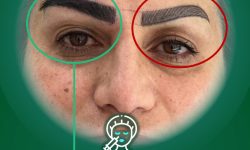 مرکز کاشت ابرو تهران کلینیک زیبایی آندیا در غرب تهران