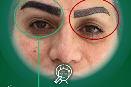 مرکز کاشت ابرو تهران کلینیک زیبایی آندیا در غرب تهران