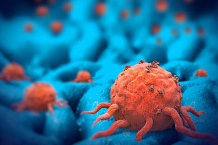 اضافه وزن خطر ابتلا به سرطان پروستات را افزایش می دهد