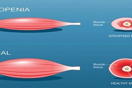 وقتی تحلیل عضلات، استقلال فردی را می‌گیرد