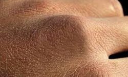 ۱۰ توصیه برای مراقبت از پوست خشک در پاییز