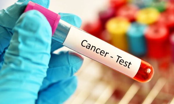 کدام سرطانها در کرمانشاه شایعترند؟